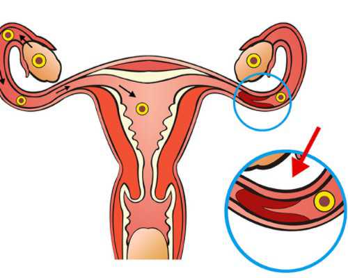 <b>23岁卵巢早衰能自愈吗&供卵试管婴儿流程,如何给宝宝肌肤保湿护理保湿是呵</b>