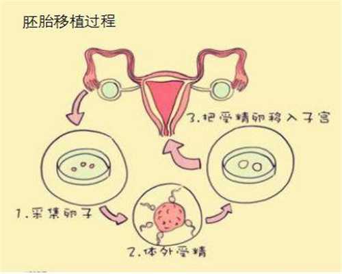 代孕胆酸高的症状有哪些 代孕胆酸高怎么办_怀孕
